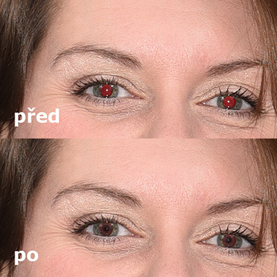 odstranění červených očí na fotografii